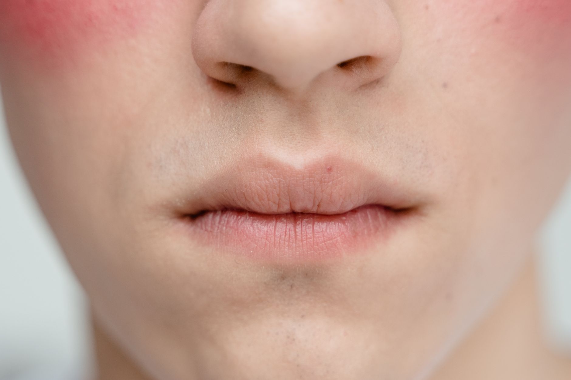 What Causes Enlarged Pores and Can Their Appearance Be Reduced?? Practical Skin Care Steps